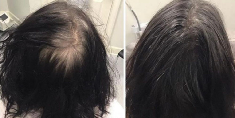 Before and After Picture